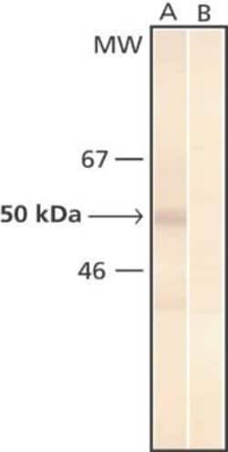 Phosphoserine Monoclonal Antibody (PSR-45), Invitrogen 100 &mu;L | Buy Online | Invitrogen | Fisher Scientific