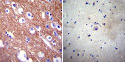 Invitrogen PMCA4 ATPase Monoclonal Antibody (JA9) 100 &mu;g; Unconjugated:Antibodies,
