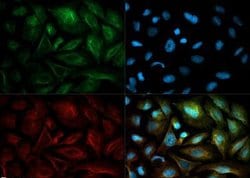 NQO1 Monoclonal Antibody (A180), Invitrogen 100 &mu;L | Buy Online | Invitrogen | Fisher Scientific