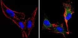 Invitrogen™ Recoverin Monoclonal Antibody (6a55 cd6)