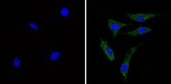 Invitrogen Recoverin Monoclonal Antibody (6a55 cd6) 100 &mu;g | Buy Online | Invitrogen&trade; | Fisher Scientific