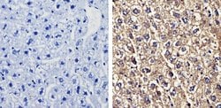 Invitrogen Recoverin Monoclonal Antibody (6a55 cd6) 100 &mu;g | Buy Online | Invitrogen&trade; | Fisher Scientific