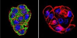Invitrogen™ CFTR Monoclonal Antibody (CF3)