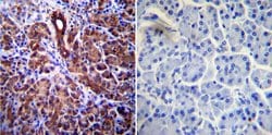 Invitrogen CFTR Monoclonal Antibody (CF3) 100 &mu;L; Unconjugated:Antibodies,