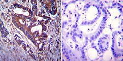 Invitrogen CFTR Monoclonal Antibody (CF3) 100 &mu;L; Unconjugated:Antibodies,