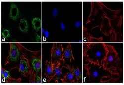 Invitrogen Adiponectin Monoclonal Antibody (19F1) 100 &mu;g; Unconjugated:Antibodies,