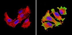 Invitrogen eIF1 Monoclonal Antibody (2B9) 100 &mu;g; Unconjugated:Antibodies,