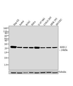Invitrogen SOD2 Monoclonal Antibody (1H6) 100 &mu;g; Unconjugated:Antibodies,