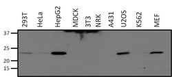 Invitrogen SOD2 Monoclonal Antibody (1H6) 100 &mu;g; Unconjugated:Antibodies,