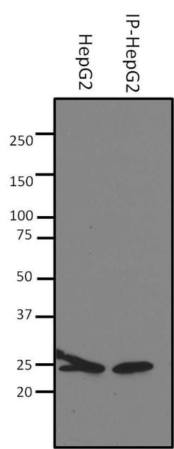 Invitrogen SOD2 Monoclonal Antibody (1H6) 100 &mu;g; Unconjugated:Antibodies,