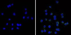 Invitrogen CD11c Monoclonal Antibody (N418) 500 &mu;g; Unconjugated:Antibodies,