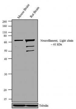 Invitrogen NEFL Monoclonal Antibody (DA2) 100 &mu;g; Unconjugated:Antibodies,