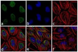 Invitrogen™ Phospho-ATM (Ser1981) Monoclonal Antibody (10H11)