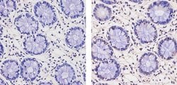 Invitrogen THRB Monoclonal Antibody (J52) 100 &mu;L; Unconjugated:Antibodies,