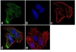 Invitrogen AKT3 Monoclonal Antibody (66C1247.1) 100 &mu;g; Unconjugated:Antibodies,