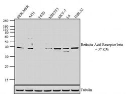 Invitrogen RARB Monoclonal Antibody (R beta 28) 50 &mu;g; Unconjugated:Antibodies,