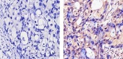 Invitrogen ErbB4 Monoclonal Antibody (HFR1) 200 &mu;g; Unconjugated:Antibodies,