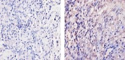 Invitrogen ErbB4 Monoclonal Antibody (HFR1) 200 &mu;g; Unconjugated:Antibodies,