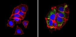 Invitrogen BAP31 Monoclonal Antibody (CC-1) 100 &mu;L; Unconjugated:Antibodies,