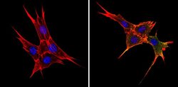 Invitrogen BAP31 Monoclonal Antibody (CC-1) 100 &mu;L; Unconjugated:Antibodies,