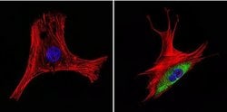 Invitrogen HSP60 Monoclonal Antibody (2E1/53) 100 &mu;g; Unconjugated:Antibodies,