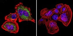 Invitrogen HSP60 Monoclonal Antibody (2E1/53) 100 &mu;g; Unconjugated:Antibodies,