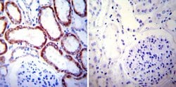 Invitrogen HSP60 Monoclonal Antibody (2E1/53) 100 &mu;g; Unconjugated:Antibodies,