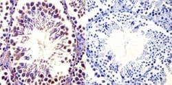 Invitrogen TCP1 Monoclonal Antibody (91A) 100 &mu;L; Unconjugated:Antibodies,