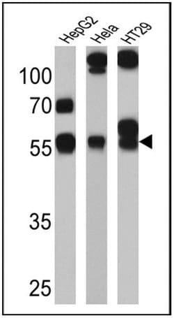 Invitrogen CYP3A7 Monoclonal Antibody (F19 P2 H2) 100 &mu;L; Unconjugated:Antibodies,