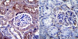 CHRNA1 Monoclonal Antibody (88B), Invitrogen 100 &mu;L; Unconjugated:Antibodies,