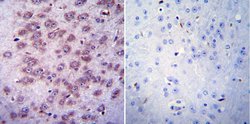 CHRNA1 Monoclonal Antibody (88B), Invitrogen 100 &mu;L; Unconjugated:Antibodies,