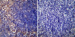 CHRNA1 Monoclonal Antibody (88B), Invitrogen 100 &mu;L; Unconjugated:Antibodies,