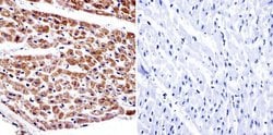 Invitrogen alpha Adaptin Monoclonal Antibody (AC1-M11) 500 &mu;L; Unconjugated:Antibodies,