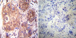 Invitrogen Estrogen Receptor alpha Monoclonal Antibody (EVG F9) 100 &mu;L;