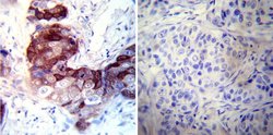 Invitrogen CRABP1 Monoclonal Antibody (C-1) 100 &mu;L; Unconjugated:Antibodies,