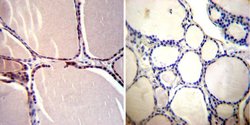 Invitrogen CRABP1 Monoclonal Antibody (C-1) 100 &mu;L; Unconjugated:Antibodies,