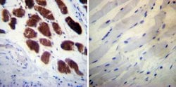 Invitrogen Calsequestrin Monoclonal Antibody (VIIID12) 100 &mu;L; Unconjugated:Antibodies,