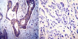Invitrogen PMCA ATPase Monoclonal Antibody (5F10) 100 &mu;L; Unconjugated:Antibodies,