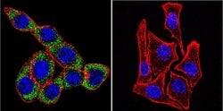Invitrogen ATP1A3 Monoclonal Antibody (XVIF9-G10) 100 &mu;g; Unconjugated:Antibodies,