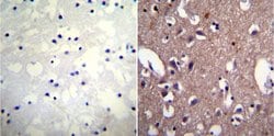 Invitrogen ATP1A1 Monoclonal Antibody (9-A5) 100 &mu;L; Unconjugated:Antibodies,