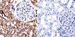 Invitrogen Mu-Calpain Monoclonal Antibody (9A4H8D3) 100 &mu;g; Unconjugated:Antibodies,