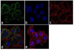 Invitrogen™ TSH Receptor Monoclonal Antibody (49)