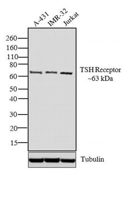 Invitrogen TSH Receptor Monoclonal Antibody (49) 100 &mu;L; Unconjugated:Antibodies,