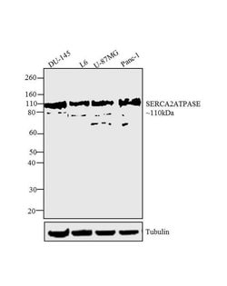 Invitrogen SERCA2 ATPase Monoclonal Antibody (2A7-A1) 100 &mu;L; Unconjugated:Antibodies