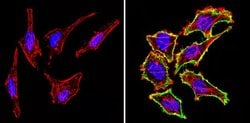 Invitrogen CD44 Monoclonal Antibody (1M7.8.1) 500 &mu;g; Unconjugated:Antibodies,