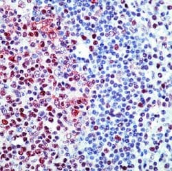 E2F4 Monoclonal Antibody (4E2F04 (WUF10)), Invitrogen 500 &mu;L; Unconjugated:Antibodies,