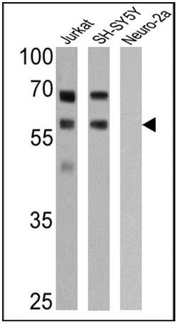 Invitrogen p57 Kip2 Monoclonal Antibody (57P06 (KP10)) 500 &mu;L; Unconjugated:Antibodies,