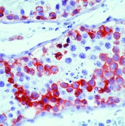 MAGE1 Monoclonal Antibody (MA454), Invitrogen 500 &mu;L; Unconjugated:Antibodies,