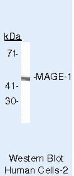 MAGE1 Monoclonal Antibody (MA454), Invitrogen 500 &mu;L; Unconjugated:Antibodies,