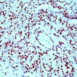 Rb Monoclonal Antibody (1F8 (Rb1)), Invitrogen 500 &mu;L; Unconjugated:Antibodies,